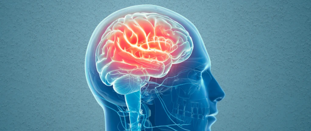 What Triggers Brain Fog in Menopause? Complete Guide